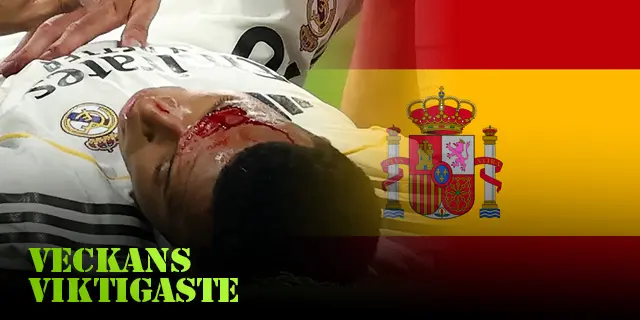 VV Spanien: Blodig Mbappé och Barcelona protesterar